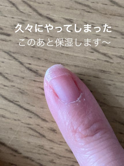 ネイルグルー/キャンドゥ/ネイル用品を使ったクチコミ(1枚目)