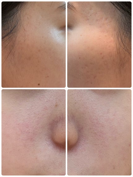 PDRN テンショントナーパッド/VT/トナーパッドを使ったクチコミ(2枚目)