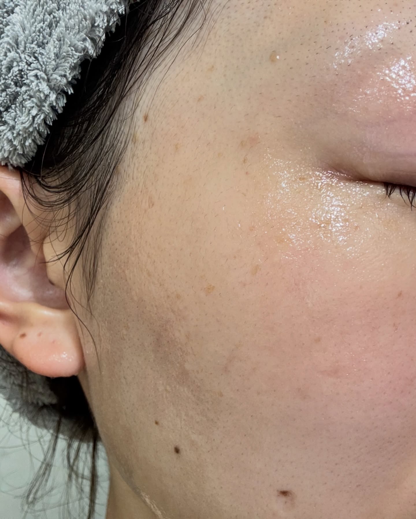 manage 00 ブースタークレンジング/manage/クレンジングジェルを使ったクチコミ（3枚目）