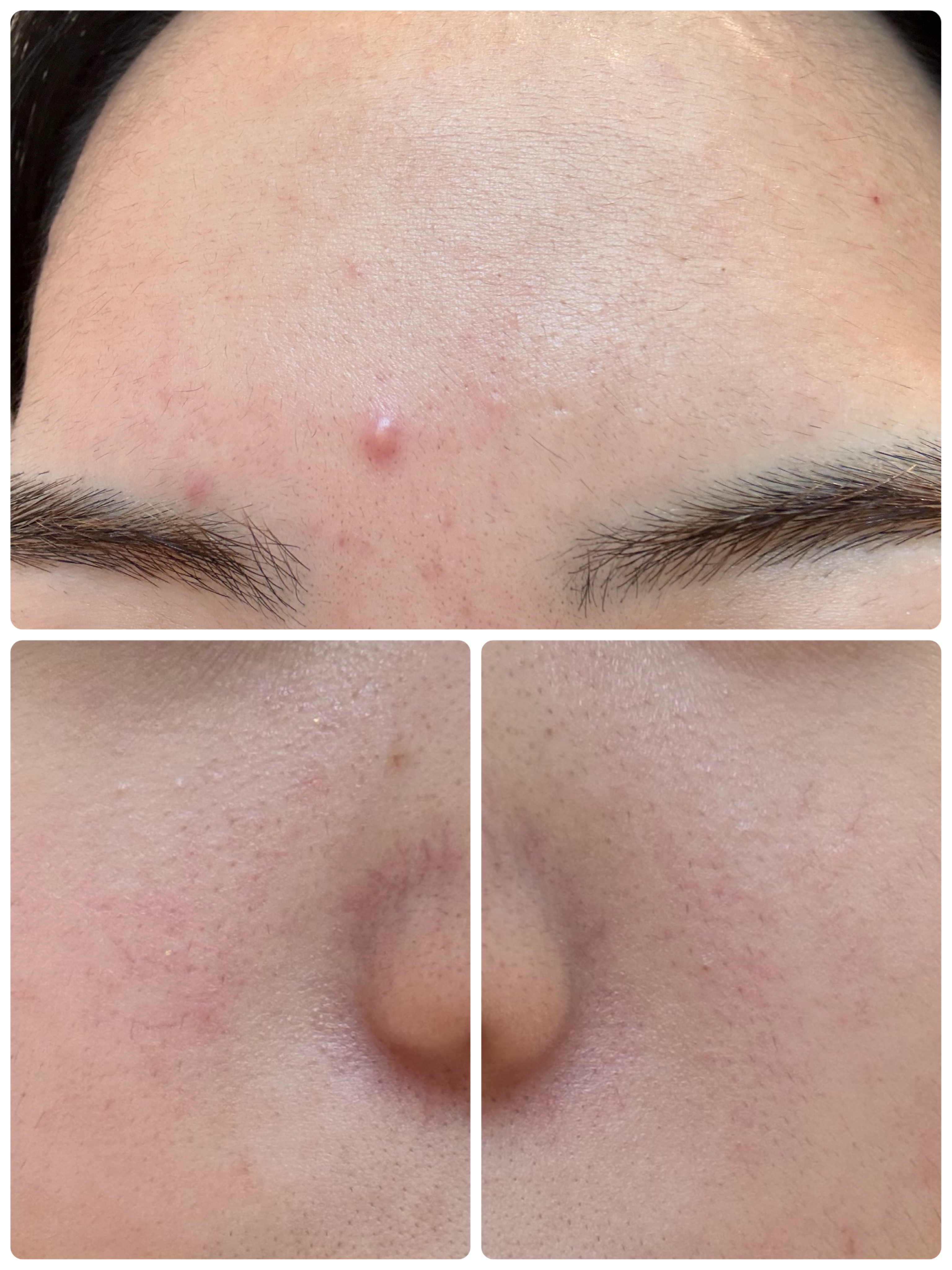 PDRN テンショントナーパッド/VT/トナーパッドを使ったクチコミ（3枚目）