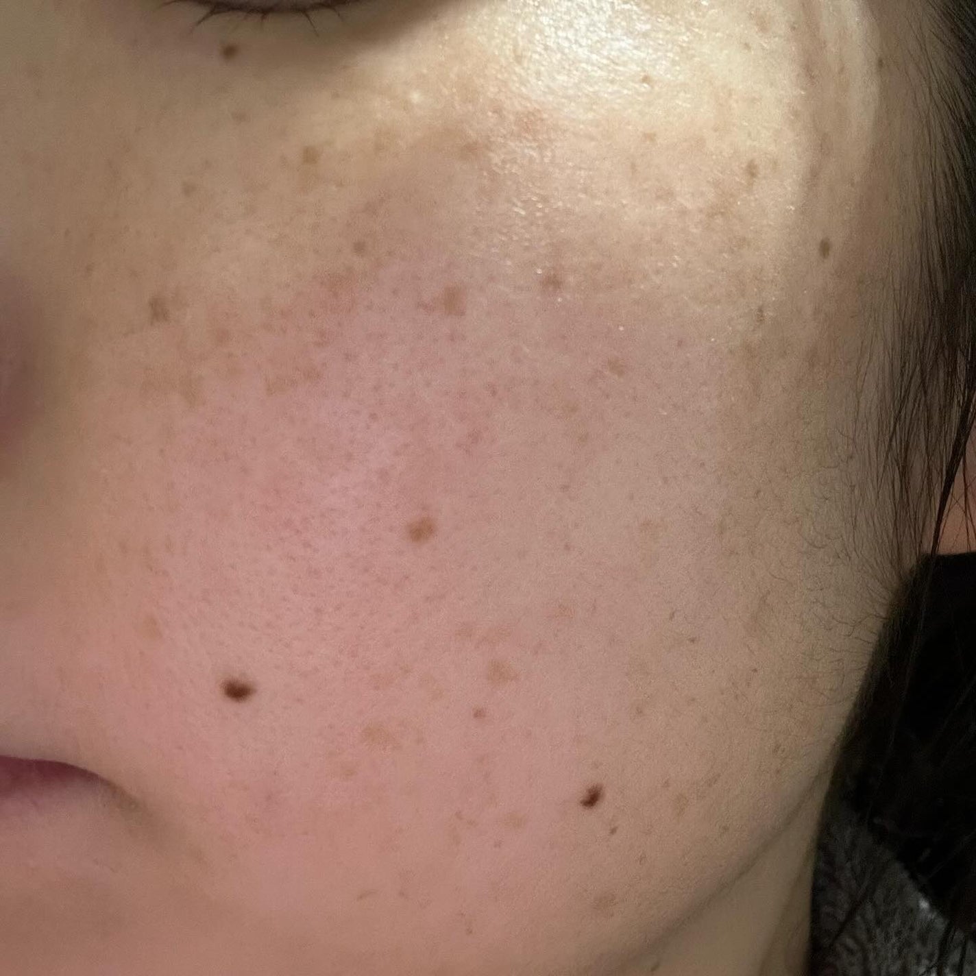 モイストバハゲル(BHA gel)/vancor(バンコル)/ピーリングを使ったクチコミ(6枚目)