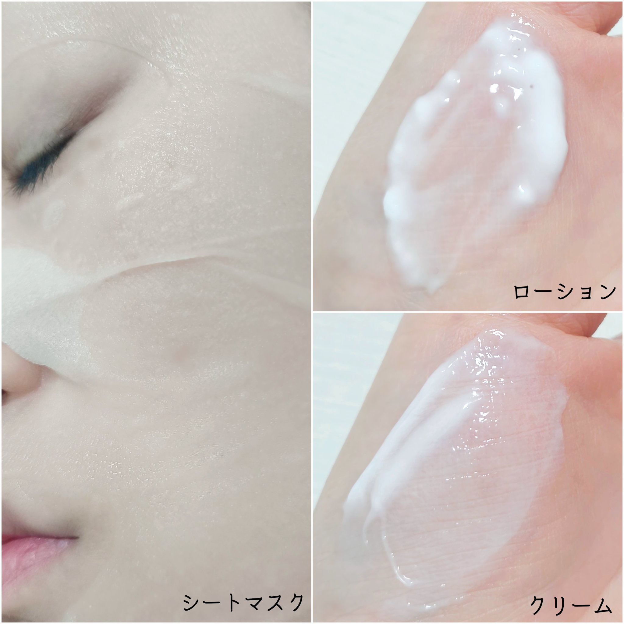 ユースキンシソラ クリーム/ユースキン/ボディクリームを使ったクチコミ（2枚目）