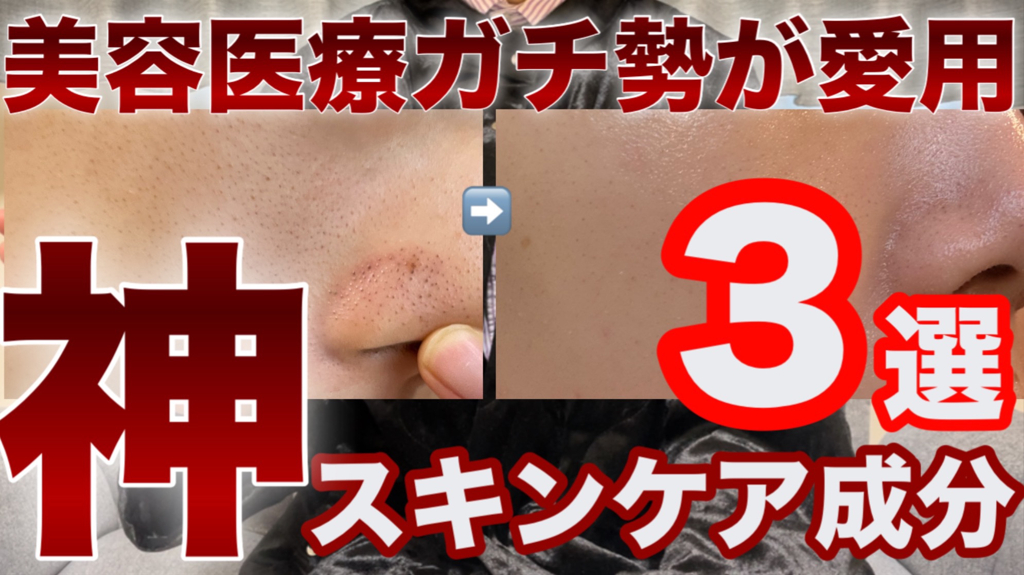 YouTube投稿しました✩.*˚

#美容医療 #美容皮膚科 #スキンケア 