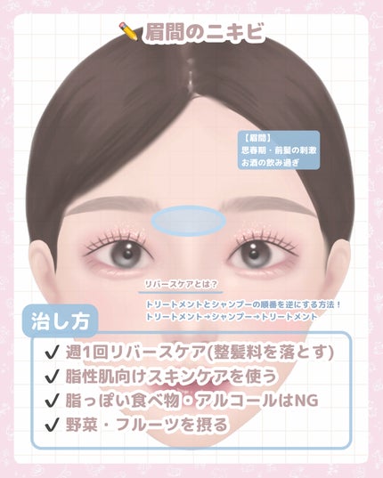 ロゼット洗顔パスタ アクネクリア/ロゼット/洗顔フォームを使ったクチコミ(5枚目)