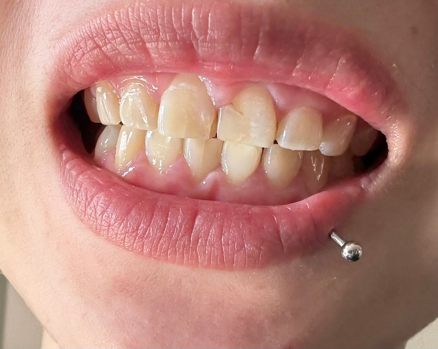 ハム太郎 on LIPS 「Liveoralsホワイトニングジェル少し白くなったかも..」(1枚目)