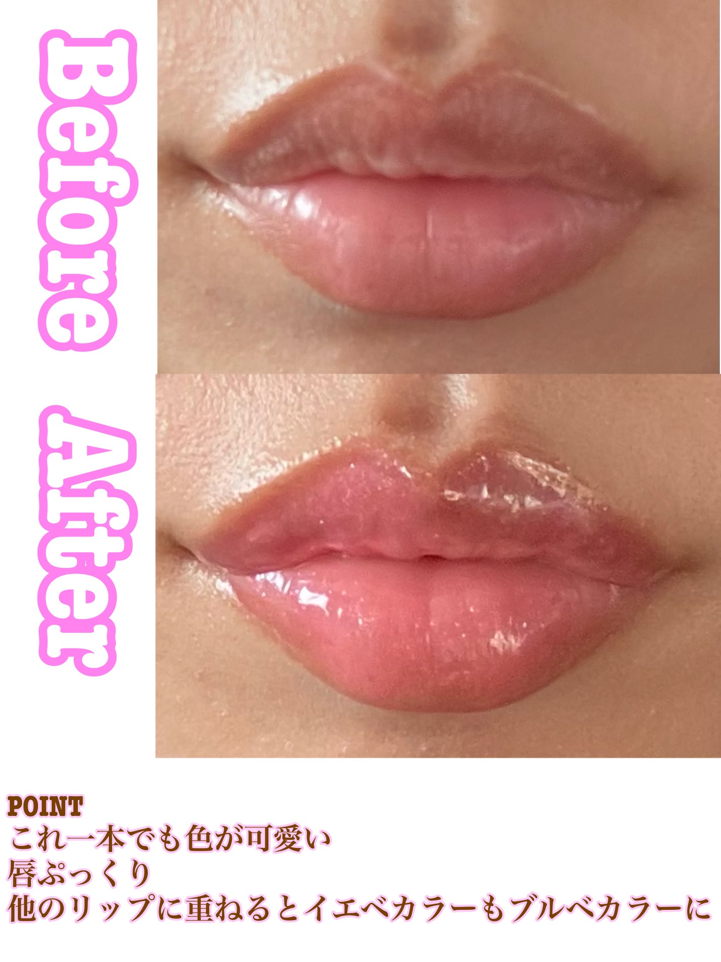 サンリットパール プランパー/tilnus/リッププランパーを使ったクチコミ(2枚目)