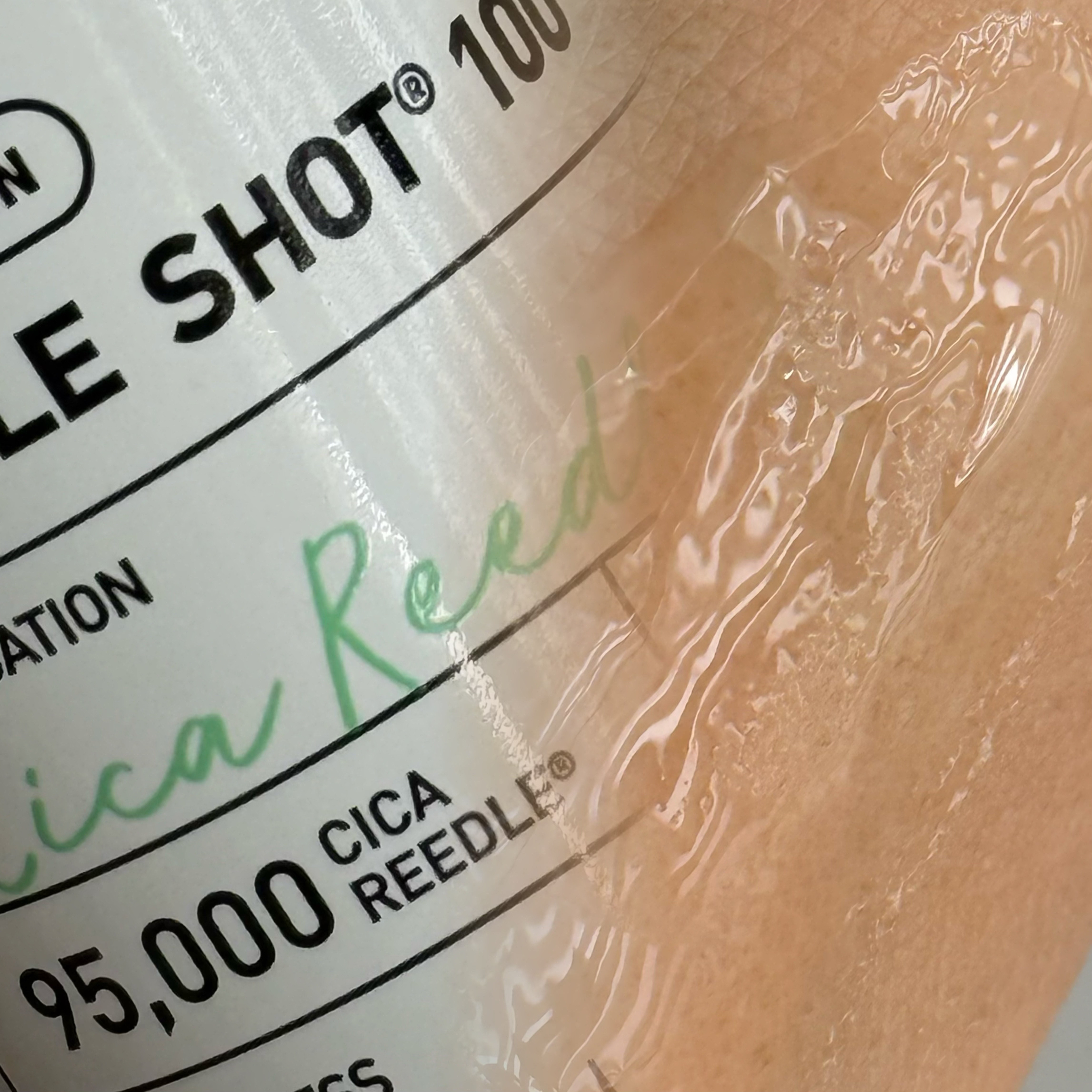 リードルショット100/VT/美容液を使ったクチコミ（3枚目）