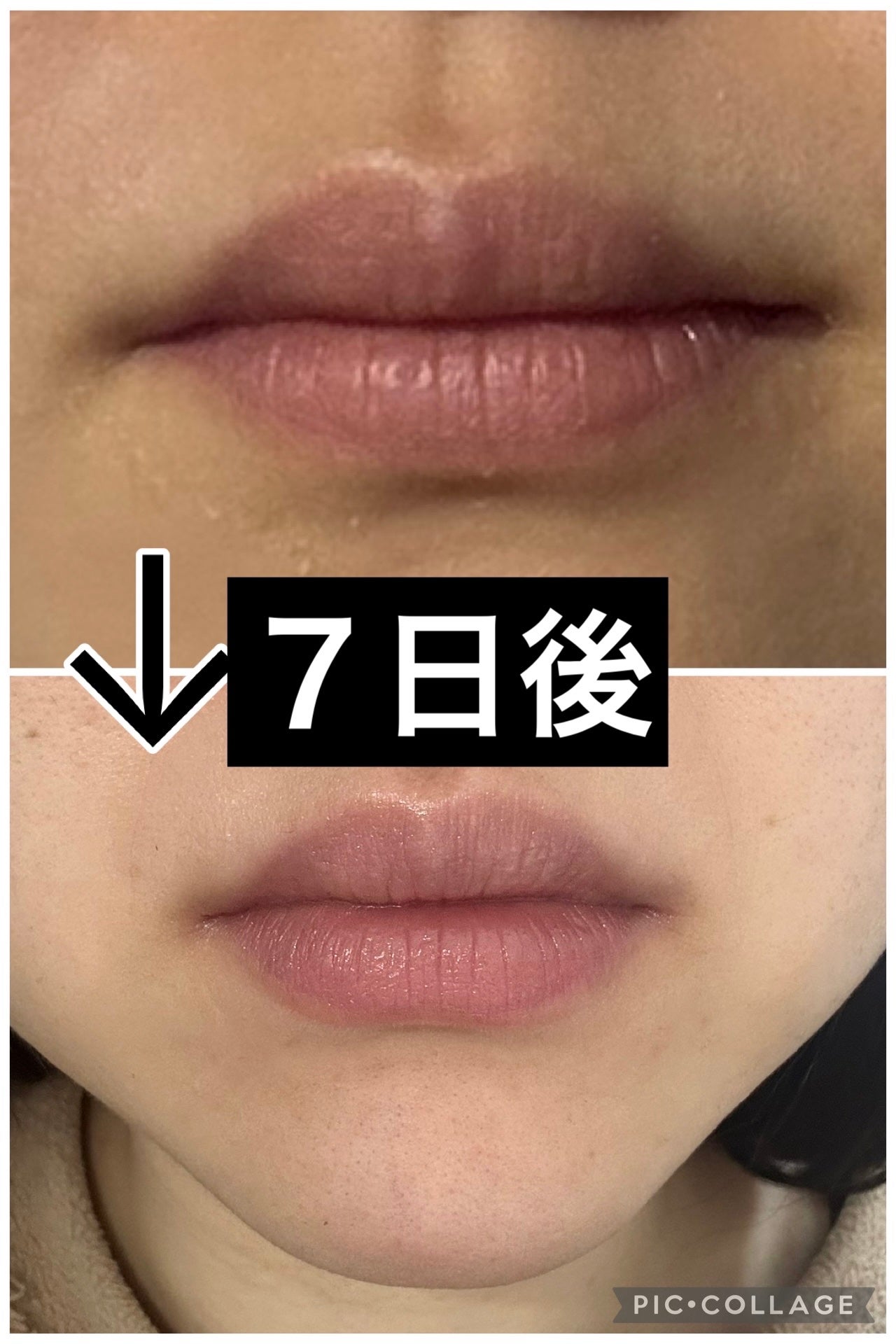 エテュセ リップエッセンス/ettusais/リップ美容液を使ったクチコミ(3枚目)