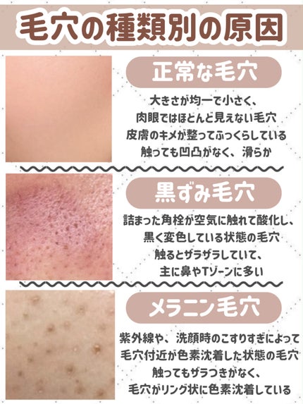 グルタチオンアンプルトナー/SKIN&LAB/化粧水を使ったクチコミ(3枚目)