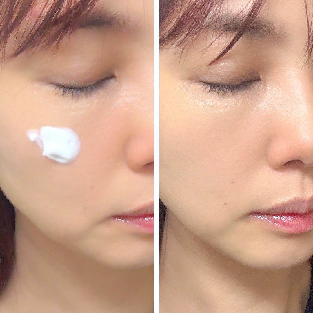 インテンシブクリーム/ZEROID/フェイスクリームを使ったクチコミ(3枚目)