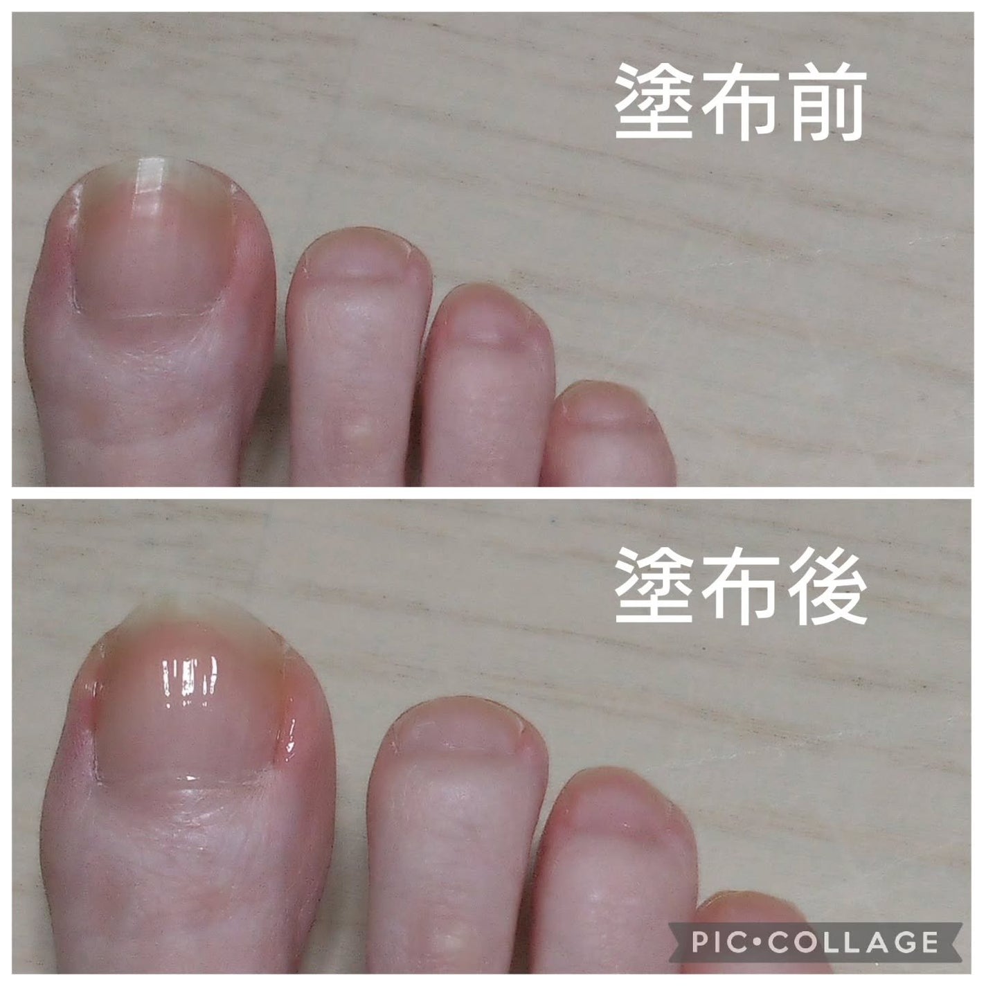 ベビーフット 足爪プロティンパック/ベビーフット/レッグ・フットケアを使ったクチコミ(4枚目)