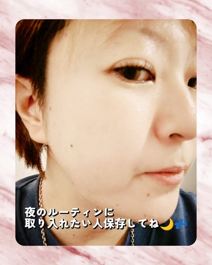 VC100エッセンスローション EX/ドクターシーラボⓇ/化粧水を使ったクチコミ(3枚目)