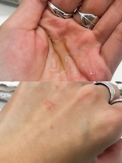 りぴ☆Webライター on LIPS 「Lowlizeファーストバランシングトナースキンリペアセラムモ..」(3枚目)