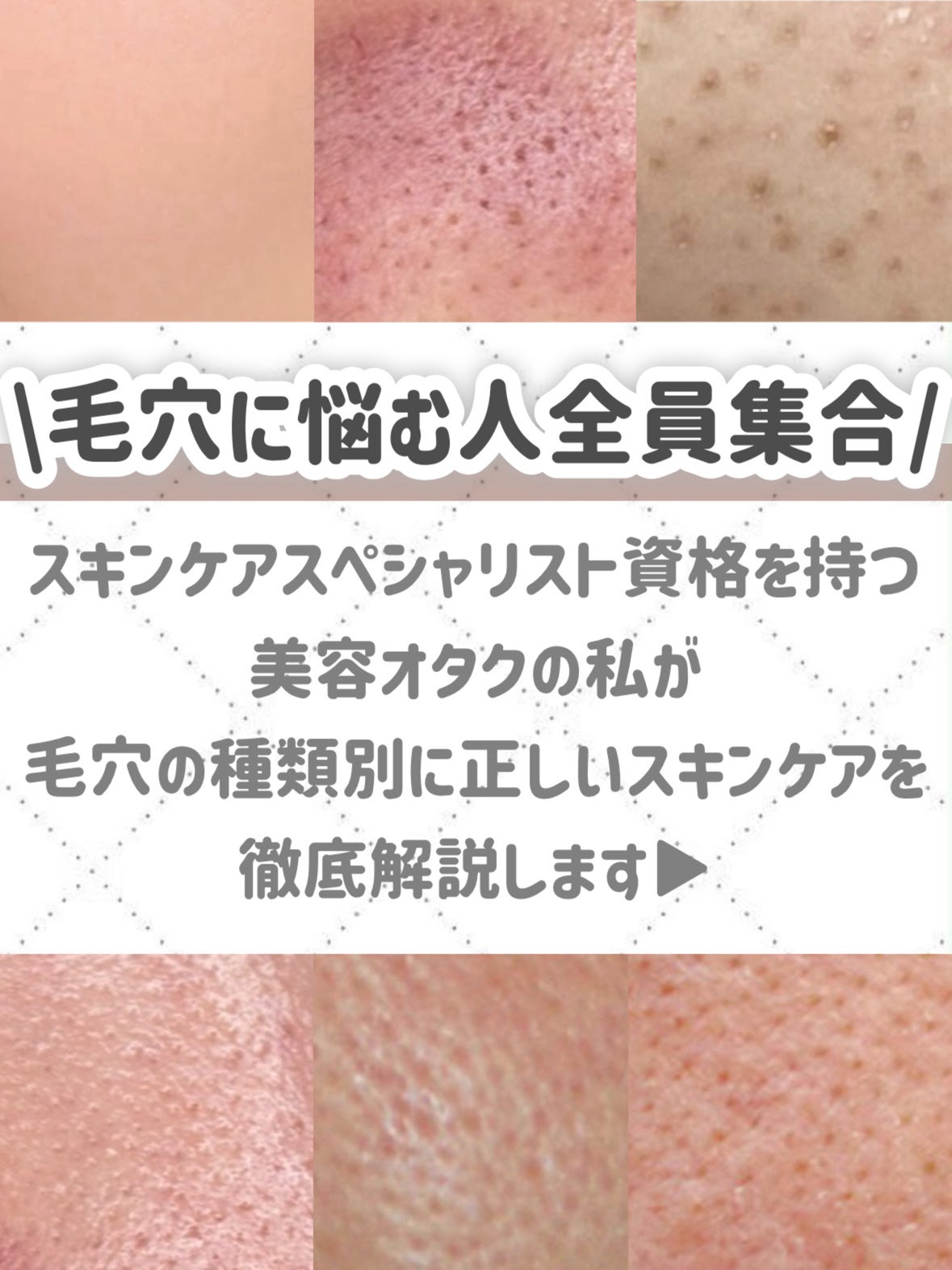 潤浸保湿 化粧水 III とてもしっとり/キュレル/化粧水を使ったクチコミ(2枚目)