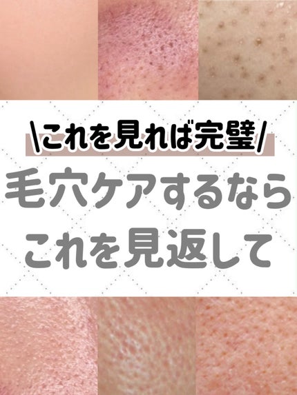 潤浸保湿 化粧水 III とてもしっとり/キュレル/化粧水を使ったクチコミ(10枚目)