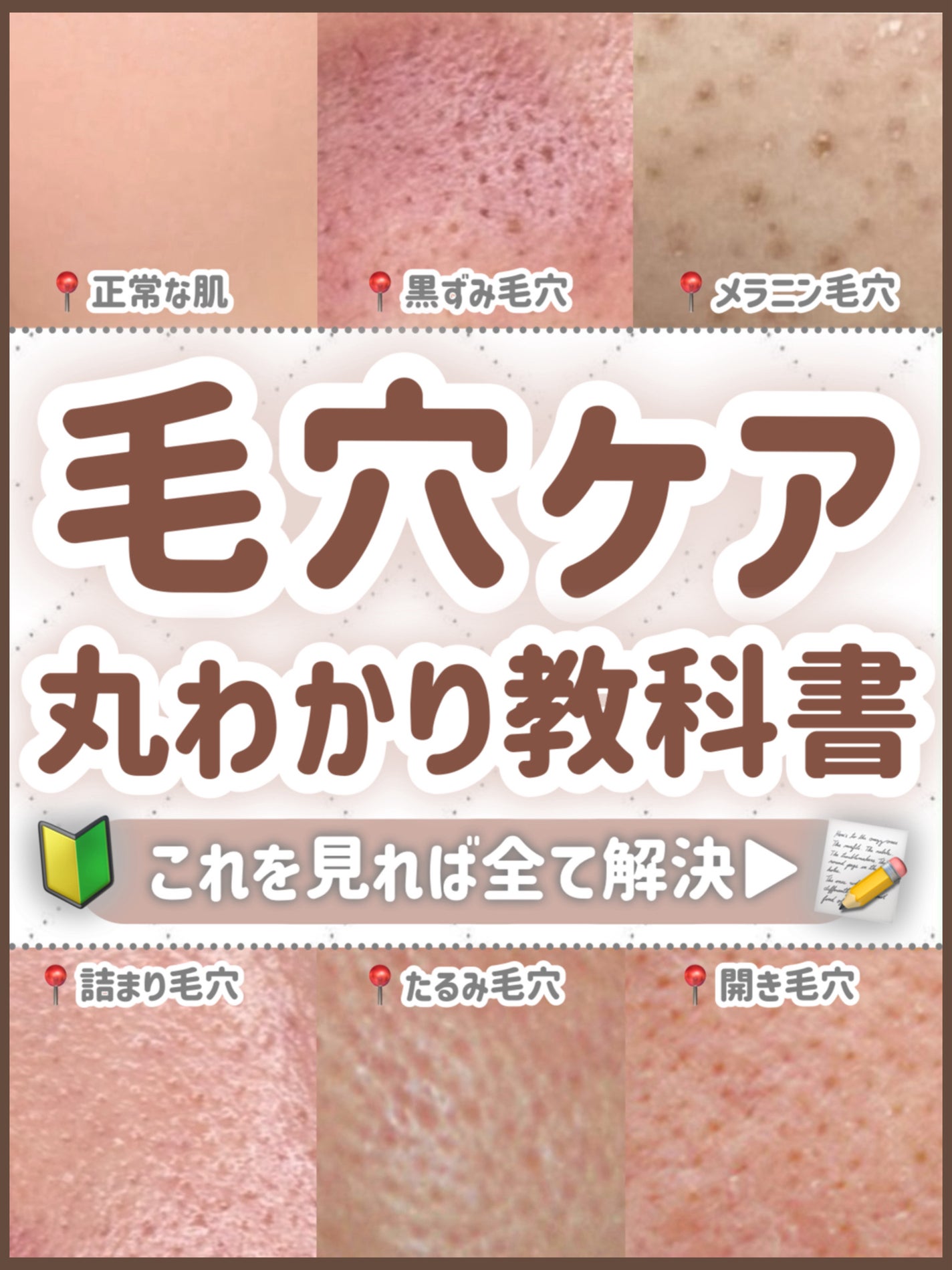 潤浸保湿 化粧水 III とてもしっとり/キュレル/化粧水を使ったクチコミ(1枚目)