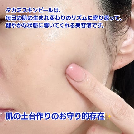 タカミスキンピール/タカミ/ブースター・導入液を使ったクチコミ(4枚目)