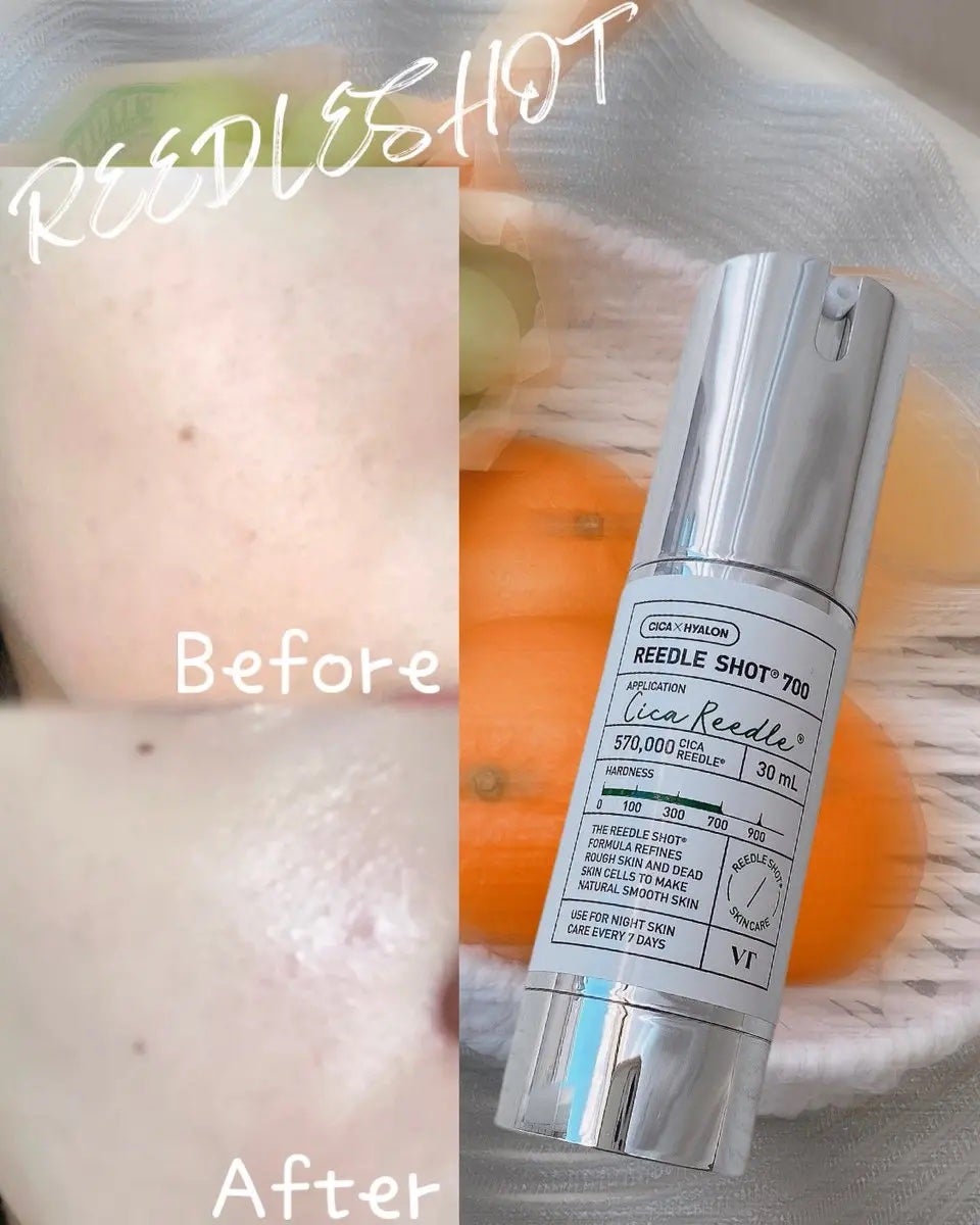 リードルショット100/VT/美容液を使ったクチコミ(4枚目)