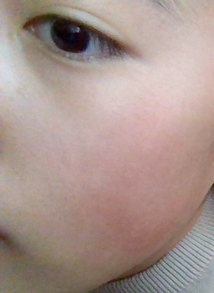 ザ・ダーマ ベストVC100プラスレチノール/クオリティファースト/シートマスク・パックを使ったクチコミ(3枚目)