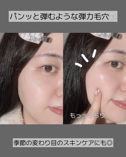 ReDRNエクソソームアンプル/Dr.nineteen/美容液を使ったクチコミ(3枚目)