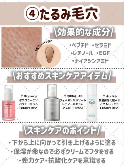 潤浸保湿 化粧水 III とてもしっとり/キュレル/化粧水を使ったクチコミ(8枚目)