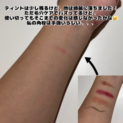 デュオ ザ クレンジングバーム ブラックリペア/DUO/クレンジングバームを使ったクチコミ(3枚目)