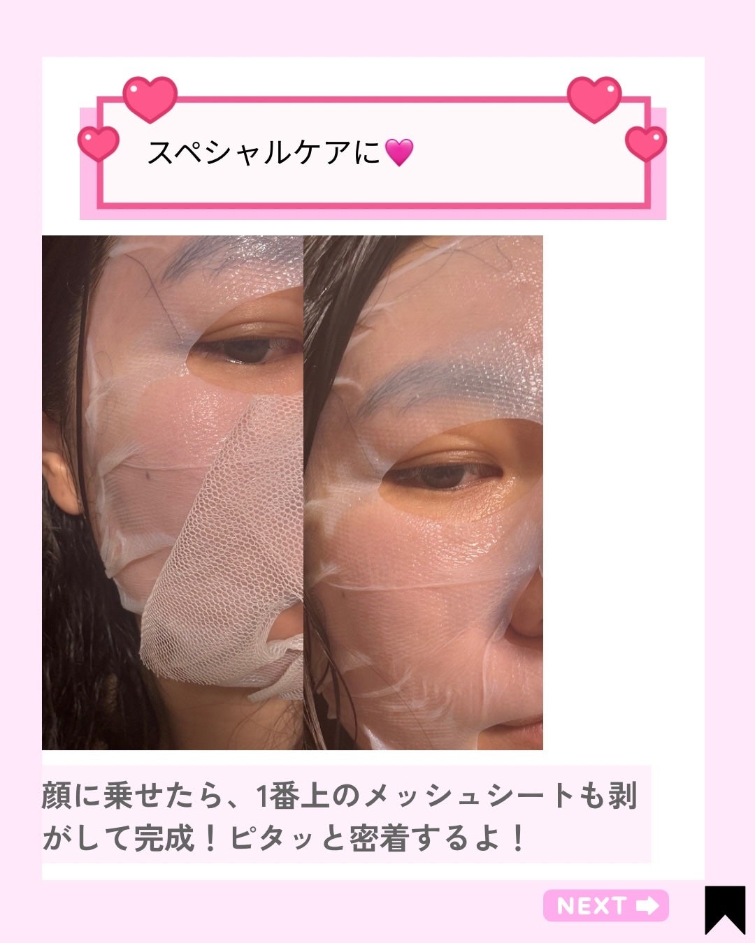 トラブルパッチマスク/EIOM/その他スキンケアを使ったクチコミ(5枚目)