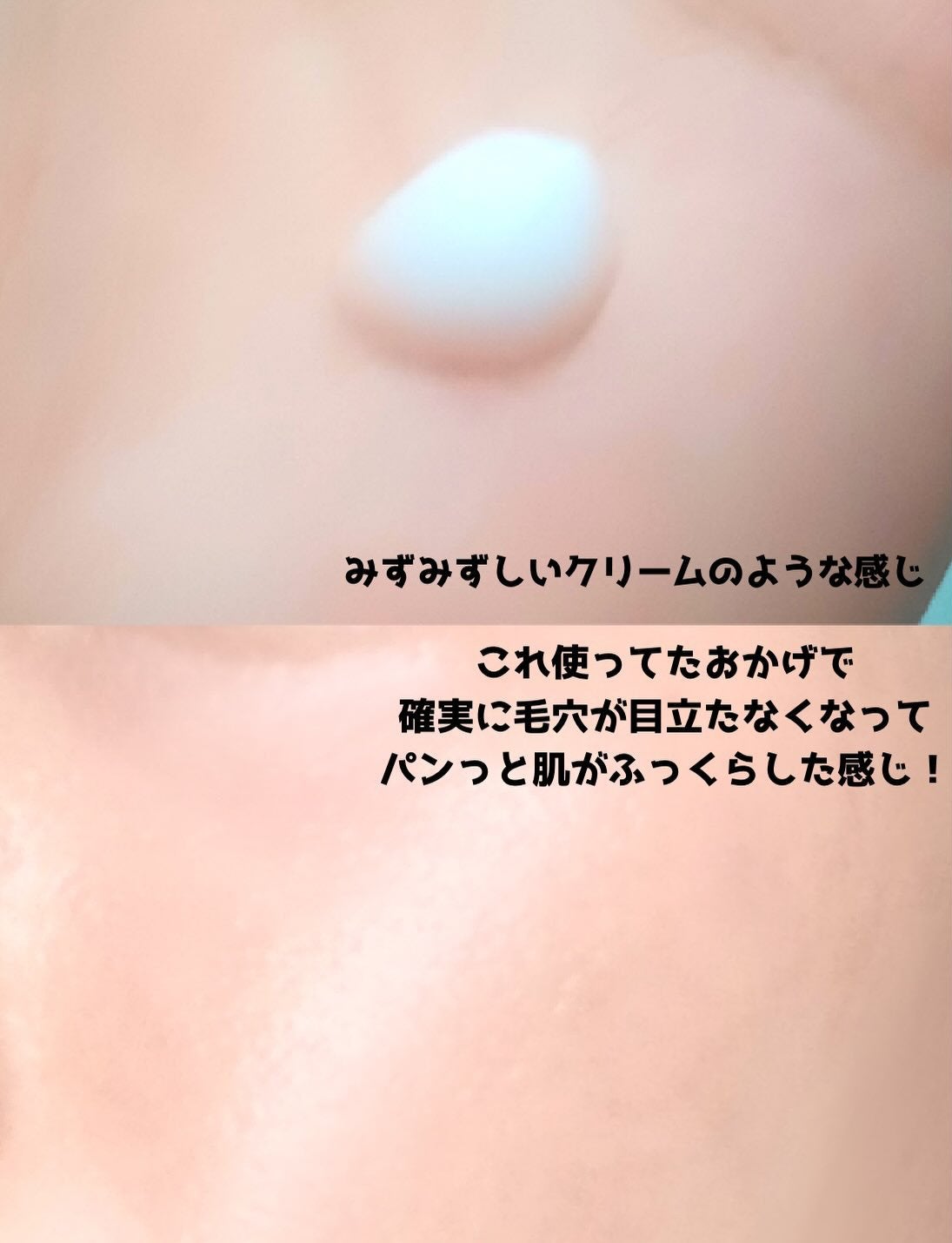 リードルショット100/VT/美容液を使ったクチコミ(5枚目)