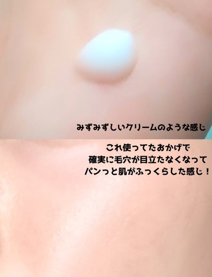 リードルショット100/VT/美容液を使ったクチコミ(5枚目)