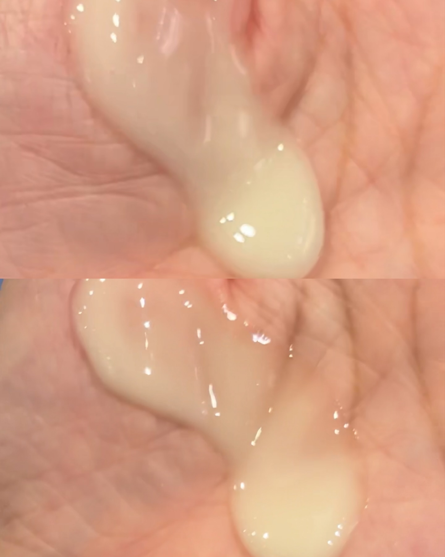 オングリディエンツ スキンバリアカーミングローション EX/Ongredients/乳液を使ったクチコミ（2枚目）