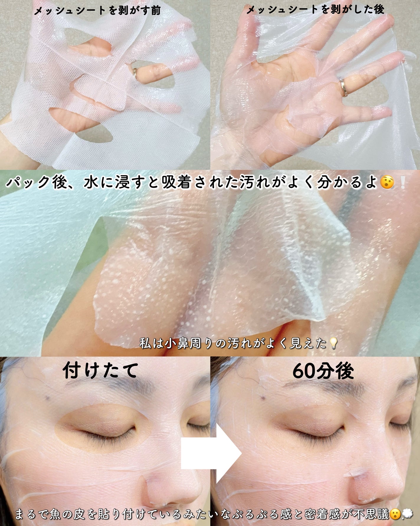 トラブルターゲティングセラム/EIOM/美容液を使ったクチコミ(3枚目)