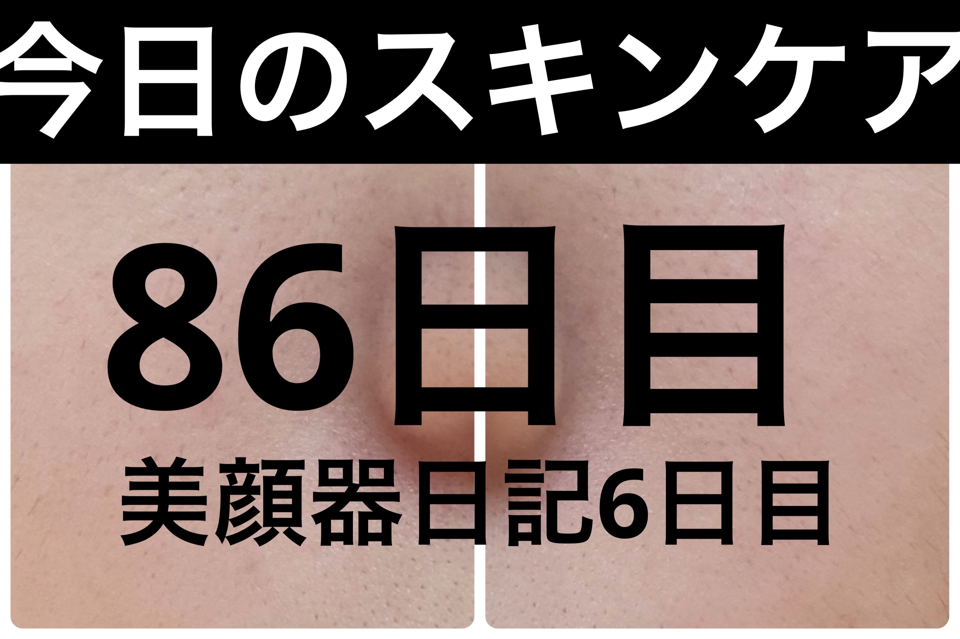 PDRN テンショントナーパッド/VT/トナーパッドを使ったクチコミ（1枚目）