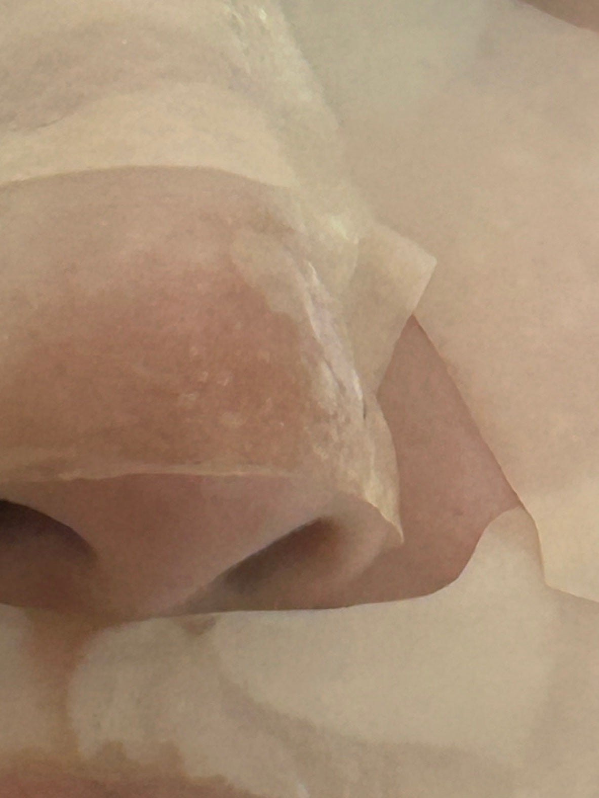 パーフェクト リアル パフォーマンス ビタコラーゲ ンマスクパック /ダーマフィックス/シートマスク・パックを使ったクチコミ(4枚目)