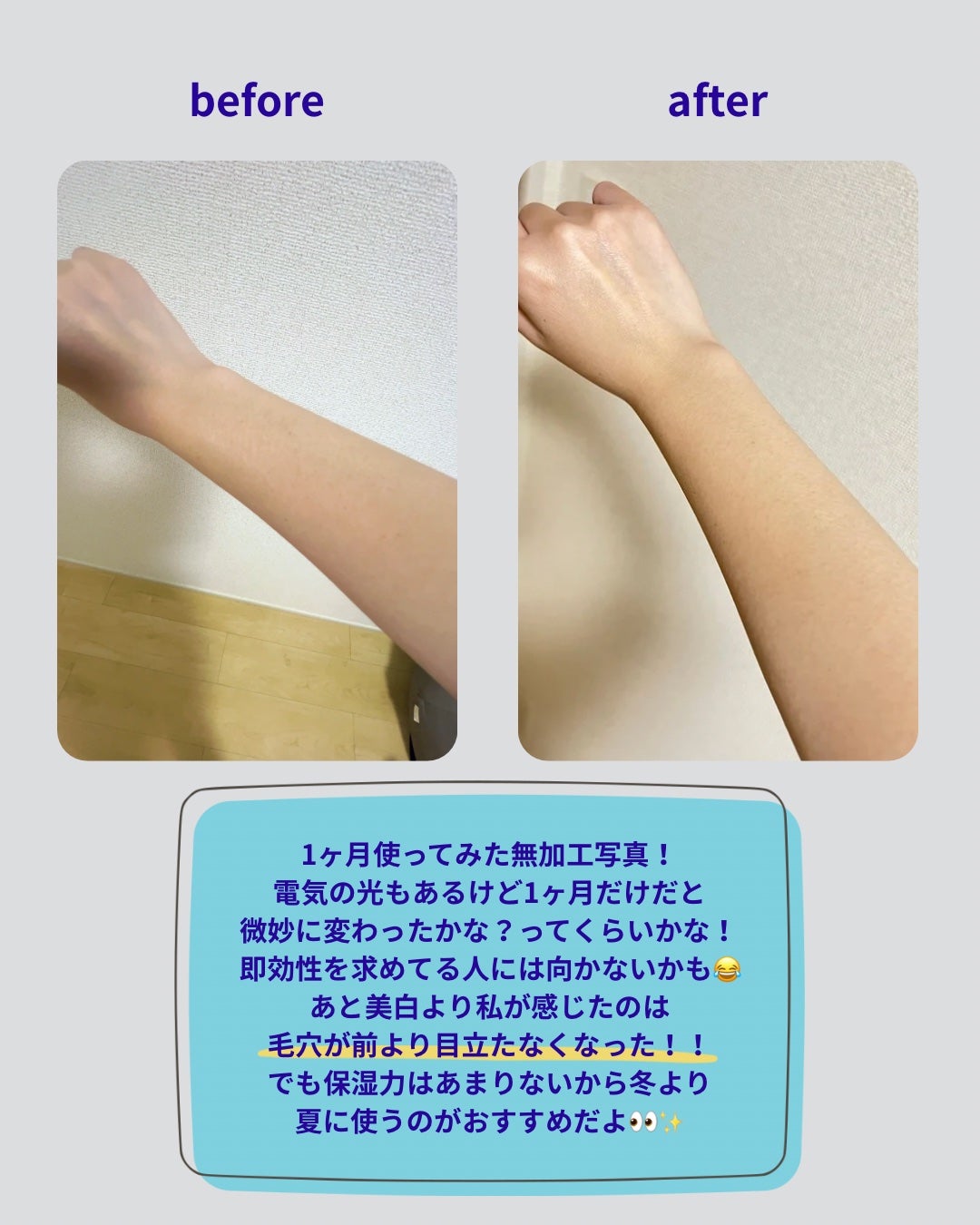 ないろ¦フォロバ100 on LIPS 「夏に焼けた肌が気になって美白にならないかなーと思って調べたらこ..」(3枚目)