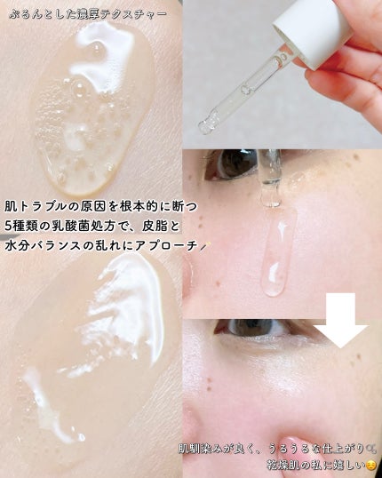 トラブルターゲティングセラム/EIOM/美容液を使ったクチコミ(7枚目)