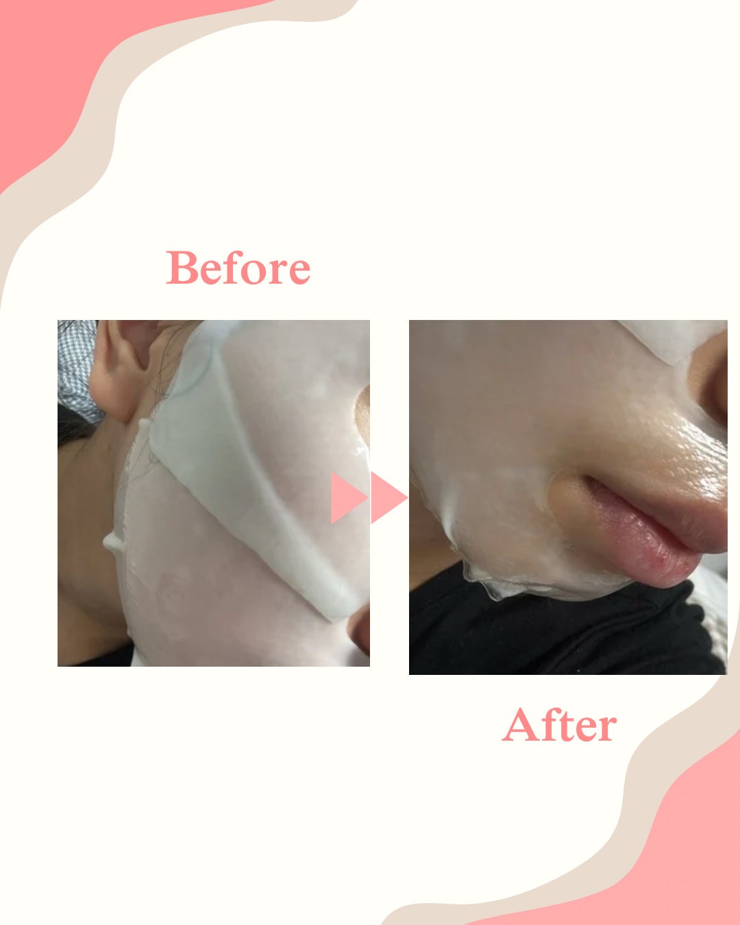 パーフェクト リアル パフォーマンス シカコラーゲンマスクパック /ダーマフィックス/シートマスク・パックを使ったクチコミ(3枚目)