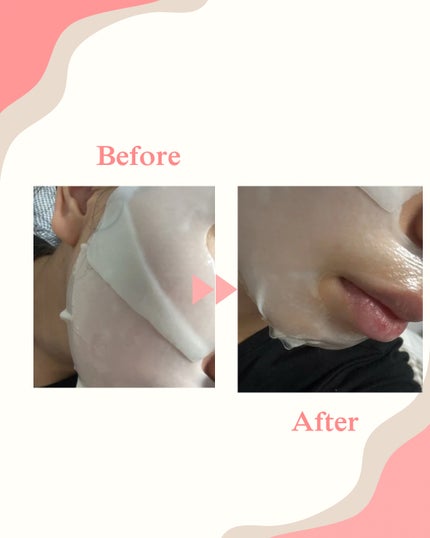 パーフェクト リアル パフォーマンス シカコラーゲンマスクパック /ダーマフィックス/シートマスク・パックを使ったクチコミ(3枚目)