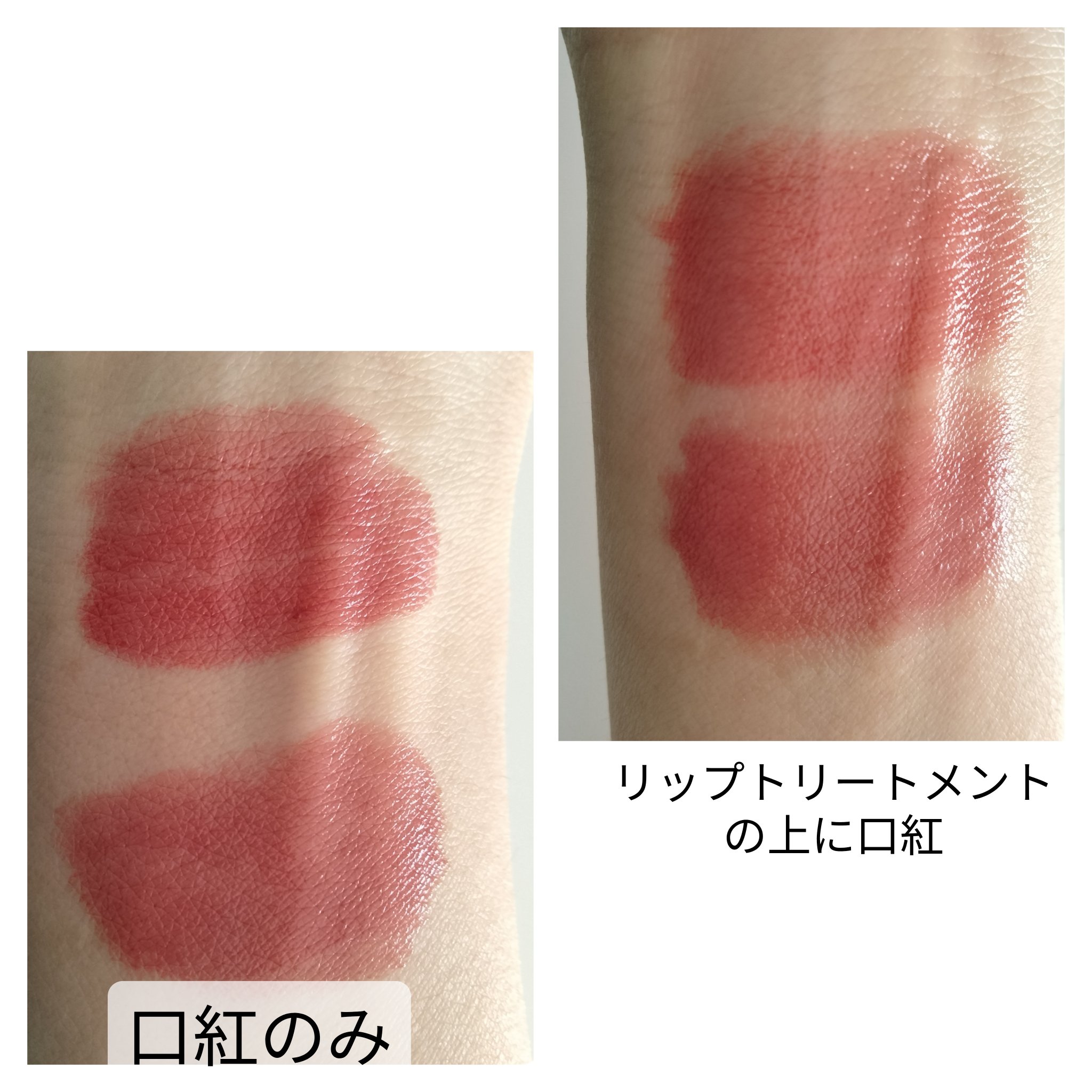 エクシア AL リップトリートメント 4-D/ALBION/リップ美容液を使ったクチコミ（2枚目）