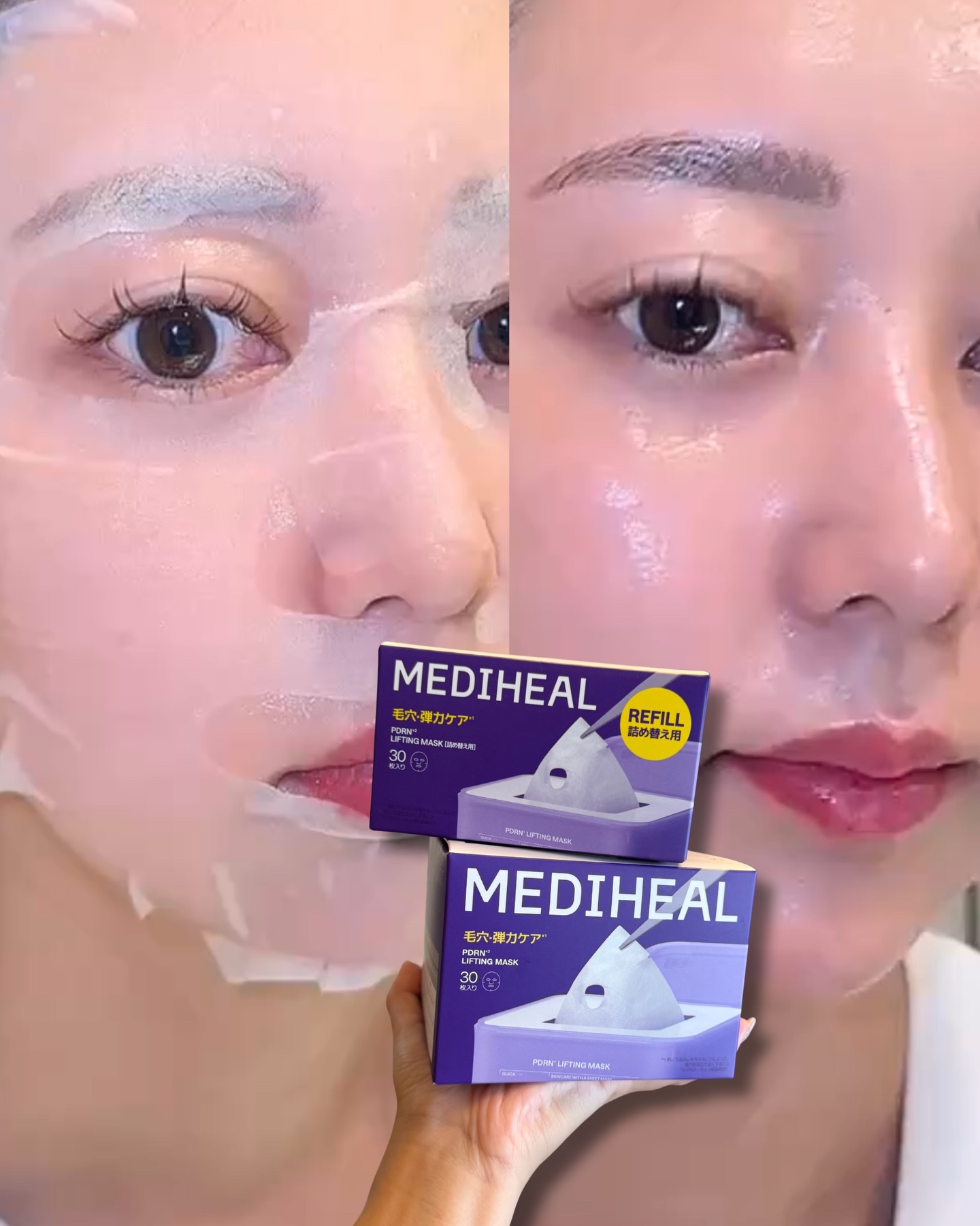 PDRN リフティングマスク/MEDIHEAL/シートマスク・パックを使ったクチコミ（2枚目）