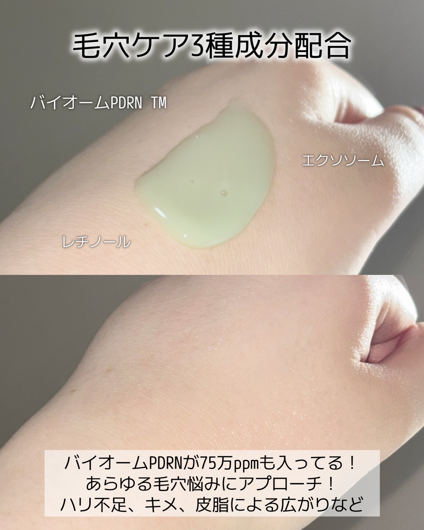 ReDRNエクソソームアンプル/Dr.nineteen/美容液を使ったクチコミ（2枚目）