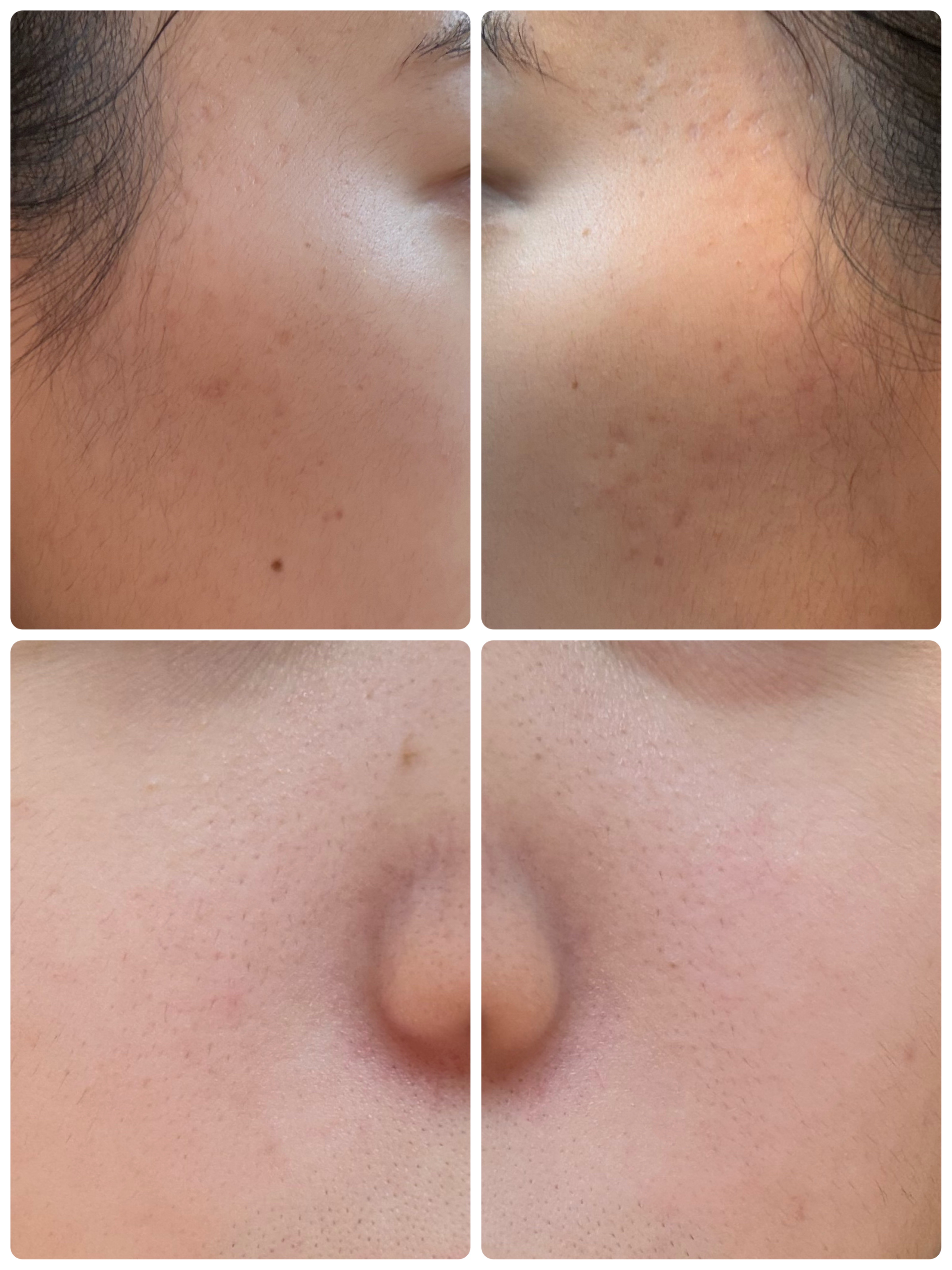 PDRN テンショントナーパッド/VT/トナーパッドを使ったクチコミ（2枚目）