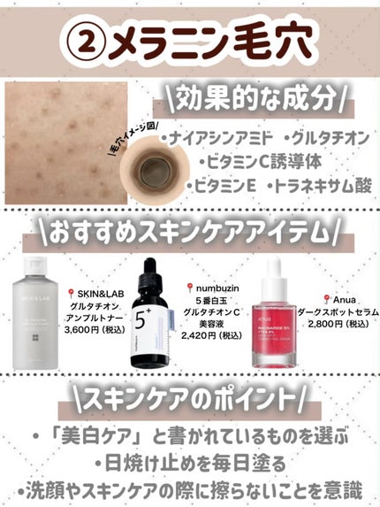 潤浸保湿 化粧水 III とてもしっとり/キュレル/化粧水を使ったクチコミ(6枚目)