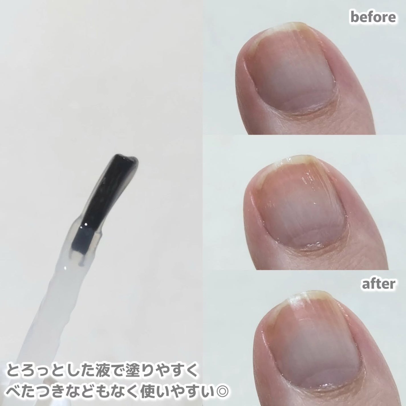 ベビーフット 足爪プロティンパック/ベビーフット/レッグ・フットケアを使ったクチコミ(3枚目)