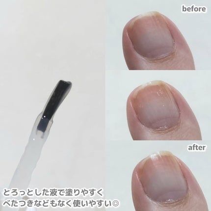 ベビーフット 足爪プロティンパック/ベビーフット/レッグ・フットケアを使ったクチコミ(3枚目)