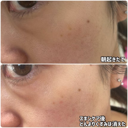 薬用ローション(とてもしっとり)/IHADA/化粧水を使ったクチコミ(4枚目)