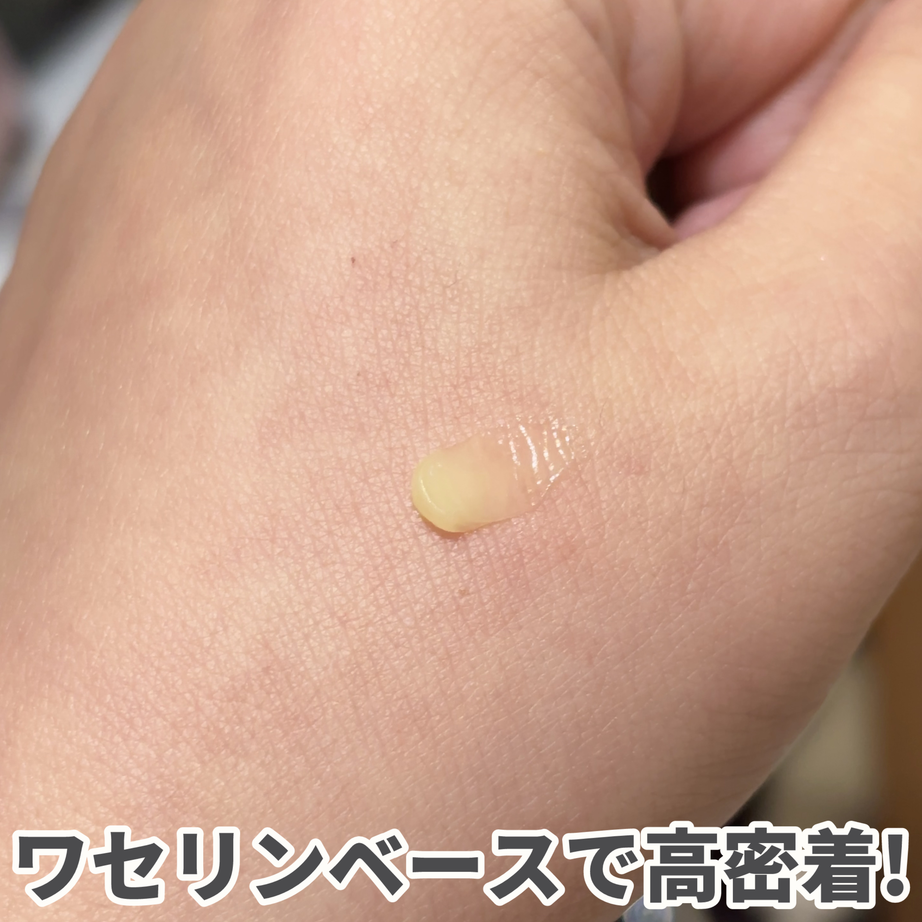 ヒビプロLP(医薬品)/メンソレータム/その他を使ったクチコミ（2枚目）