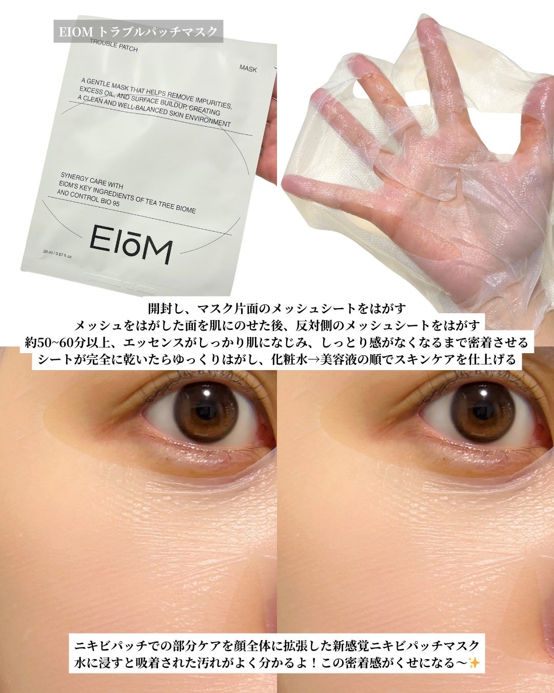 トラブルターゲティングセラム/EIOM/美容液を使ったクチコミ(3枚目)