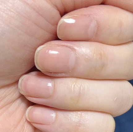 速乾性トップコート/DAISO/ネイルトップコートを使ったクチコミ(5枚目)