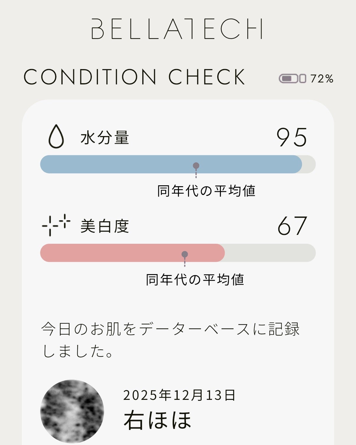 スキンスキャナー/BELLATECH/その他スキンケアグッズを使ったクチコミ(4枚目)