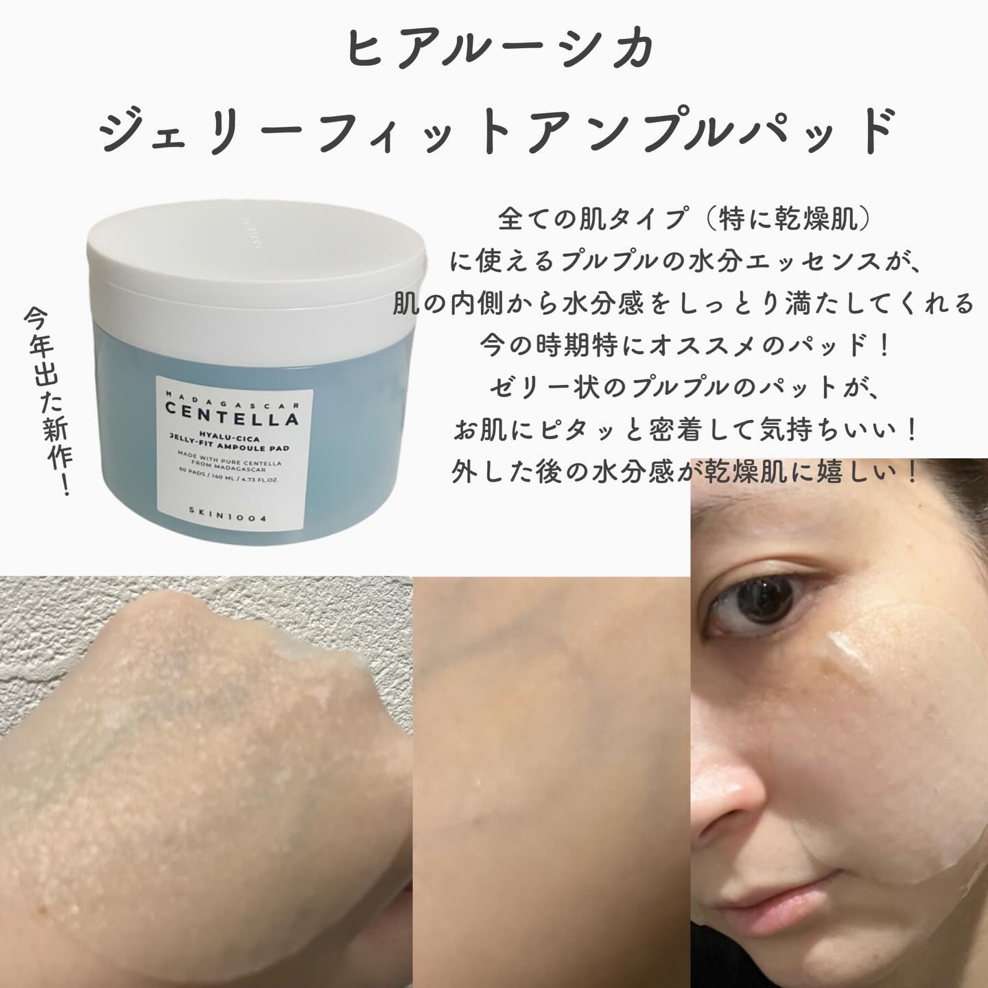 センテラ クイックカーミングパッド/SKIN1004/トナーパッドを使ったクチコミ（3枚目）